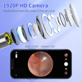 گوش پاککن هوشمند دوربیندار HD