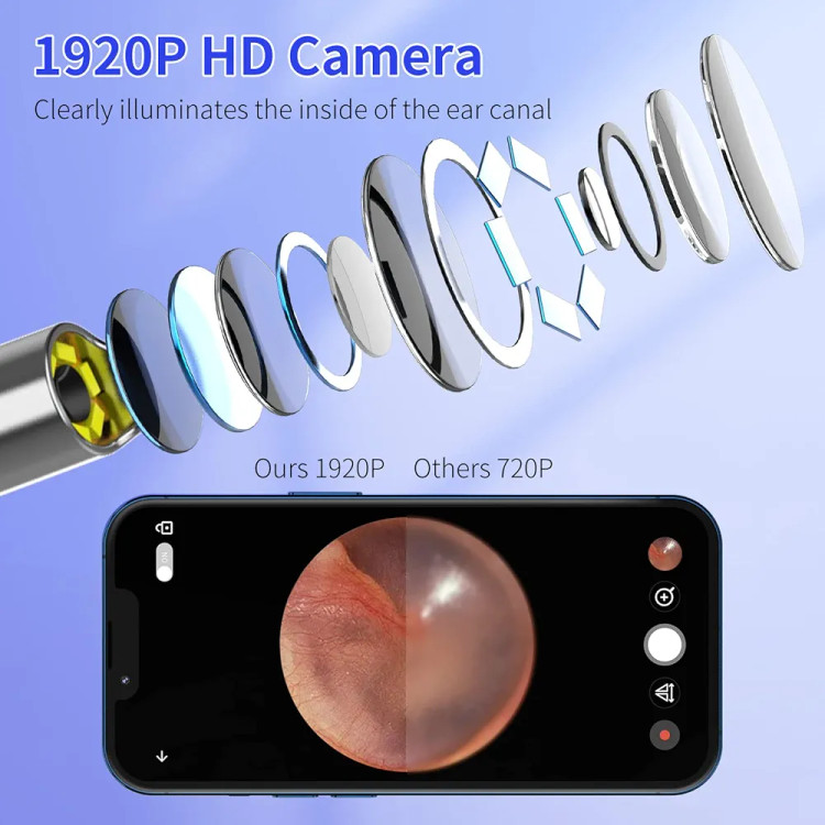 گوش پاککن هوشمند دوربیندار HD