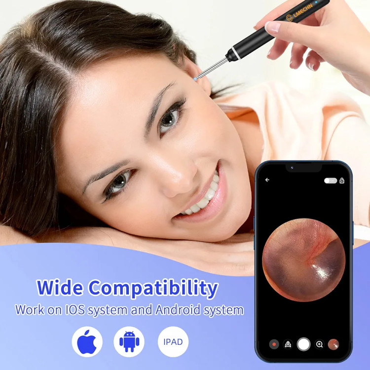 گوش پاککن هوشمند دوربیندار HD
