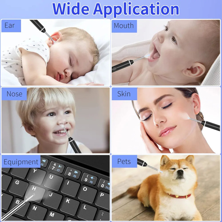 گوش پاککن هوشمند دوربیندار HD