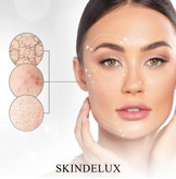 پلاسما پن فیبروبلاست (Plasma Pen Fibroblast)